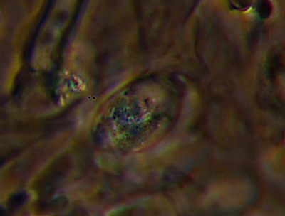 Quale Hyphoderma? (H. praetermissum?)